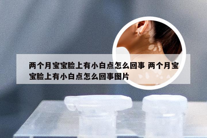 两个月宝宝脸上有小白点怎么回事 两个月宝宝脸上有小白点怎么回事图片