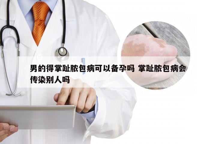 男的得掌趾脓包病可以备孕吗 掌趾脓包病会传染别人吗