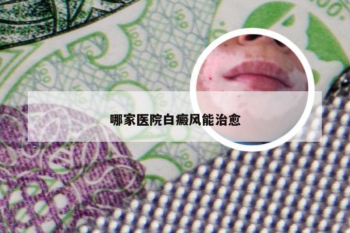 哪家医院白癜风能治愈