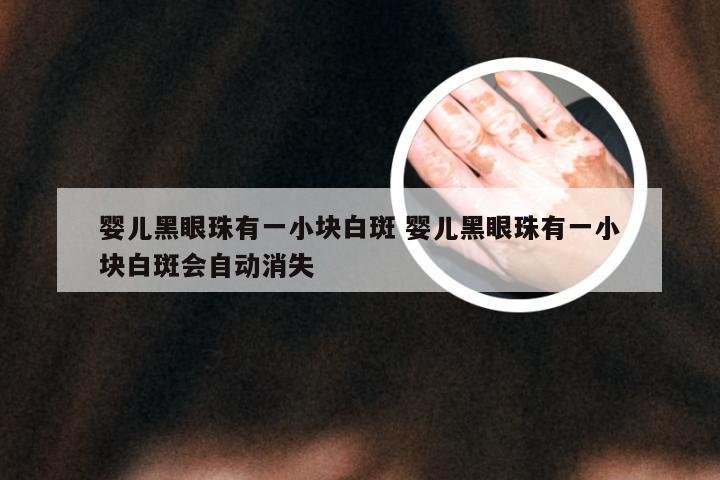 婴儿黑眼珠有一小块白斑 婴儿黑眼珠有一小块白斑会自动消失