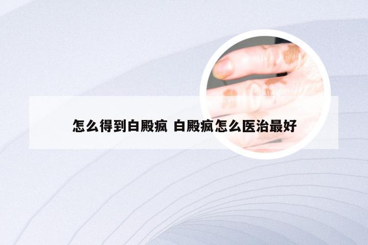 怎么得到白殿疯 白殿疯怎么医治最好