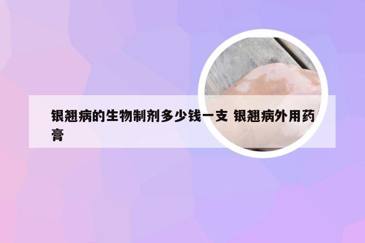 银翘病的生物制剂多少钱一支 银翘病外用药膏