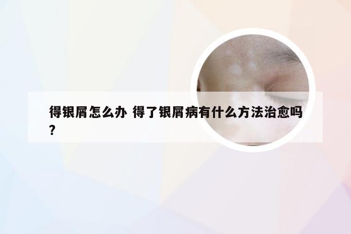 得银屑怎么办 得了银屑病有什么方法治愈吗?