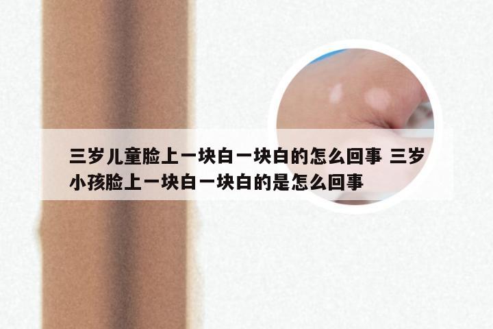 三岁儿童脸上一块白一块白的怎么回事 三岁小孩脸上一块白一块白的是怎么回事