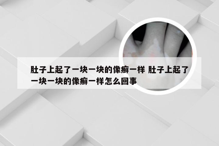 肚子上起了一块一块的像癣一样 肚子上起了一块一块的像癣一样怎么回事