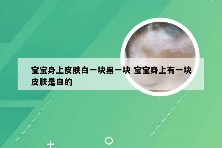 宝宝身上皮肤白一块黑一块 宝宝身上有一块皮肤是白的