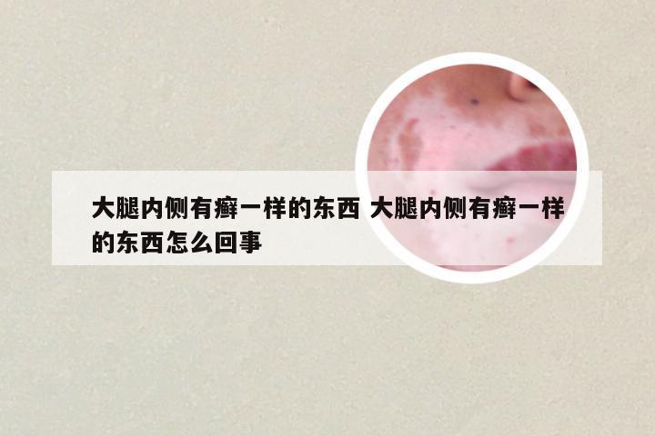 大腿内侧有癣一样的东西 大腿内侧有癣一样的东西怎么回事