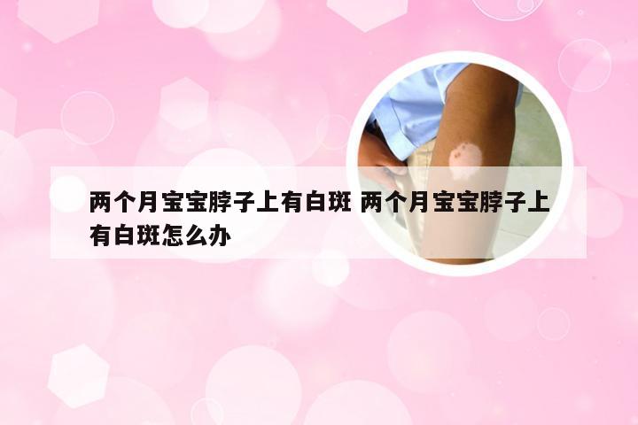 两个月宝宝脖子上有白斑 两个月宝宝脖子上有白斑怎么办