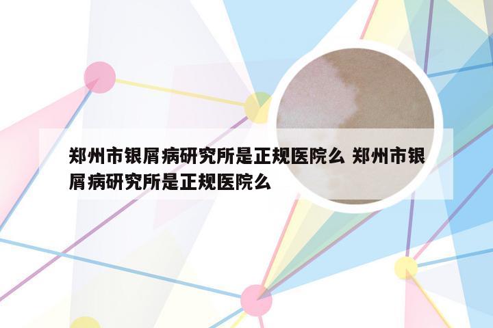 郑州市银屑病研究所是正规医院么 郑州市银屑病研究所是正规医院么