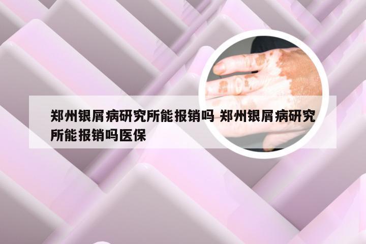 郑州银屑病研究所能报销吗 郑州银屑病研究所能报销吗医保