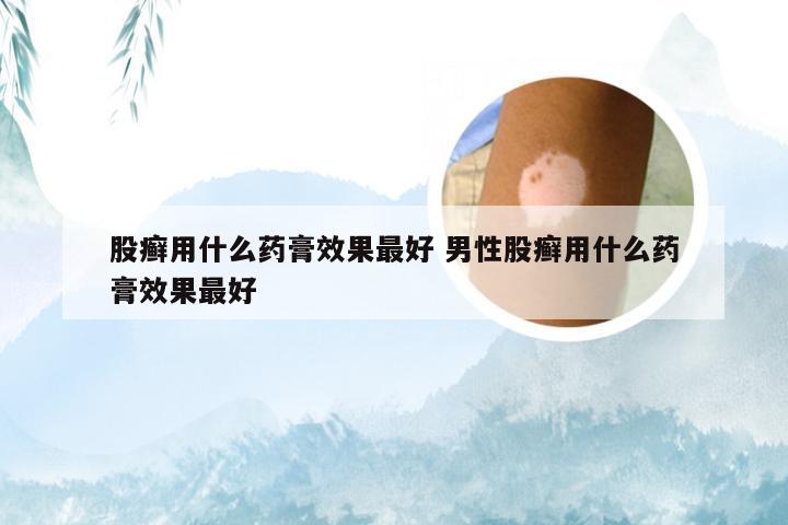 股癣用什么药膏效果最好 男性股癣用什么药膏效果最好