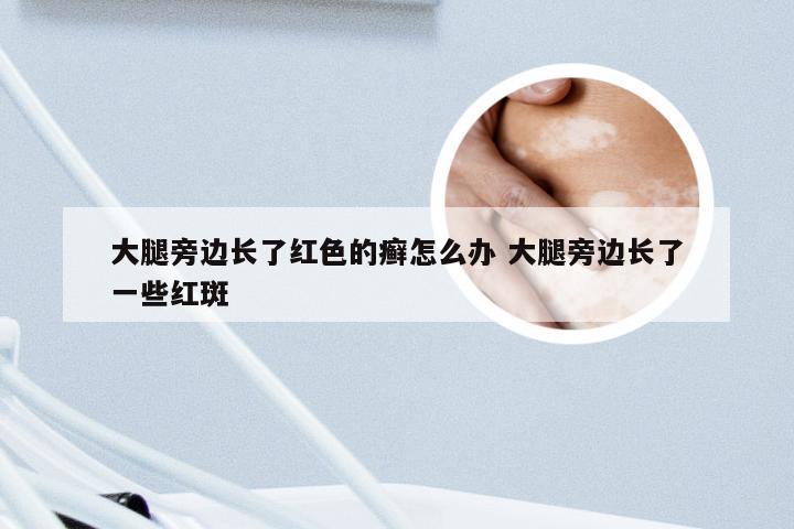 大腿旁边长了红色的癣怎么办 大腿旁边长了一些红斑