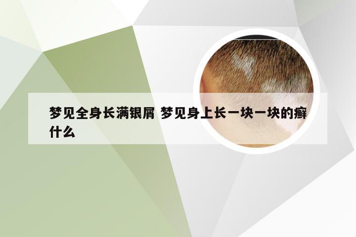 梦见全身长满银屑 梦见身上长一块一块的癣什么