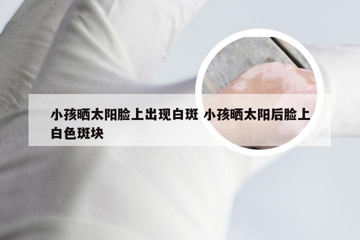 小孩晒太阳脸上出现白斑 小孩晒太阳后脸上白色斑块