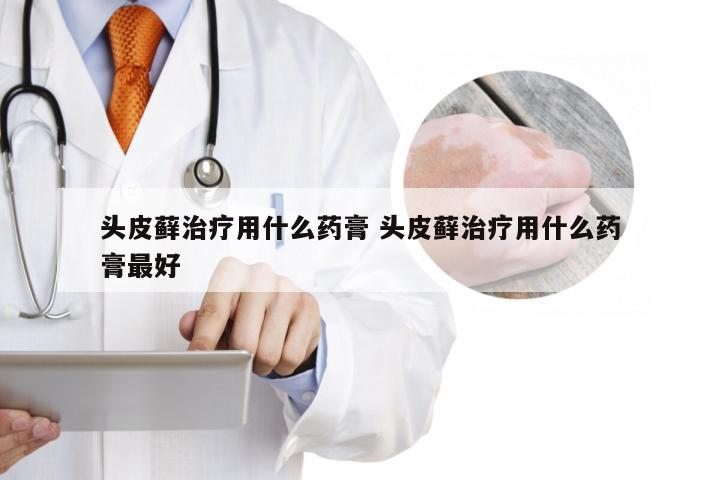 头皮藓治疗用什么药膏 头皮藓治疗用什么药膏最好