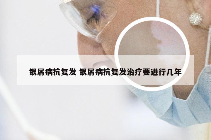 银屑病抗复发 银屑病抗复发治疗要进行几年