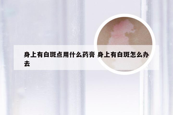 身上有白斑点用什么药膏 身上有白斑怎么办去