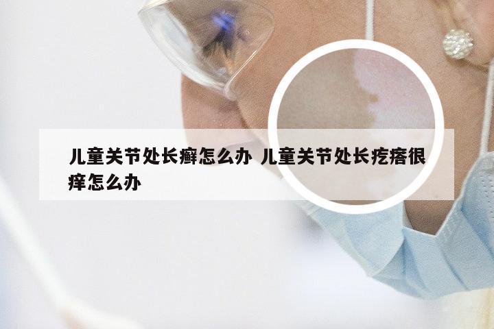 儿童关节处长癣怎么办 儿童关节处长疙瘩很痒怎么办