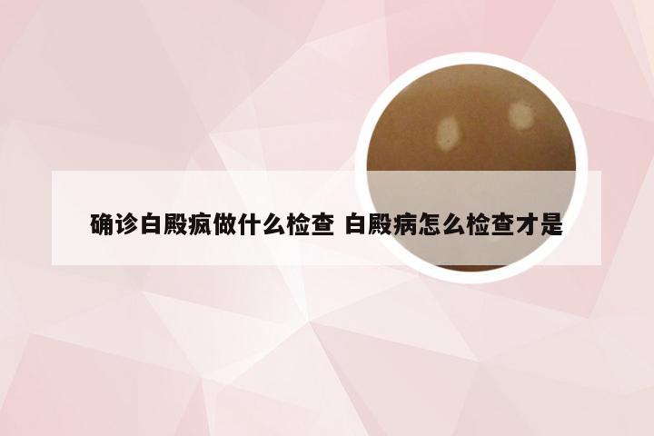 确诊白殿疯做什么检查 白殿病怎么检查才是