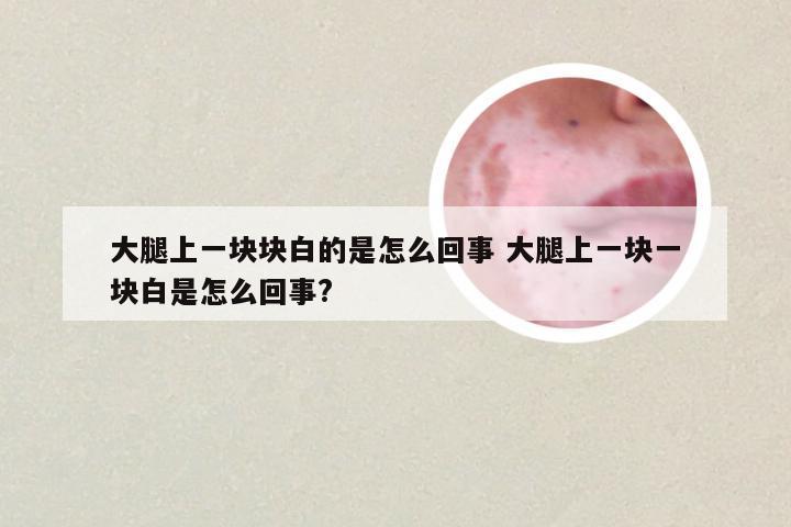 大腿上一块块白的是怎么回事 大腿上一块一块白是怎么回事?