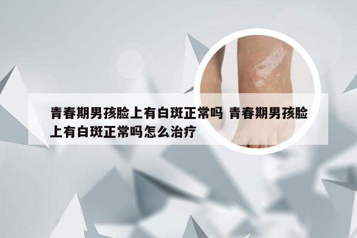 青春期男孩脸上有白斑正常吗 青春期男孩脸上有白斑正常吗怎么治疗