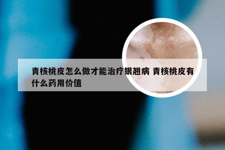 青核桃皮怎么做才能治疗银翘病 青核桃皮有什么药用价值