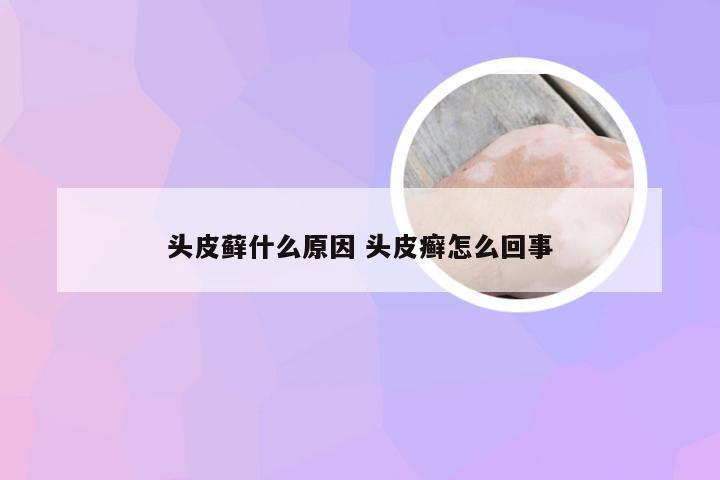 头皮藓什么原因 头皮癣怎么回事