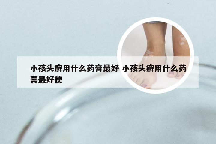 小孩头癣用什么药膏最好 小孩头癣用什么药膏最好使