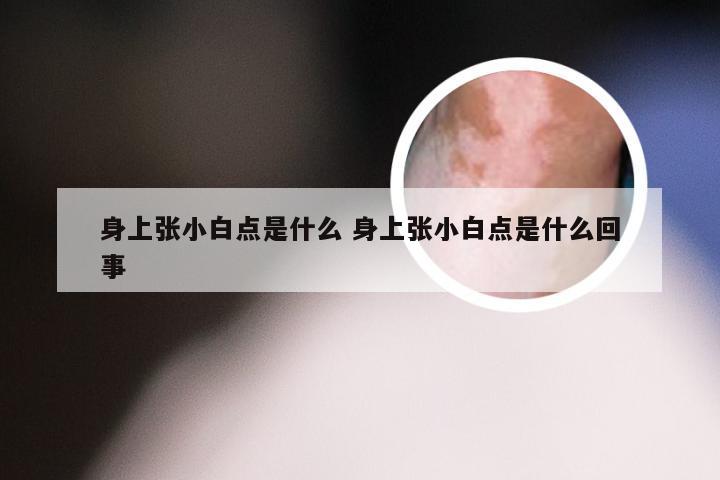 身上张小白点是什么 身上张小白点是什么回事