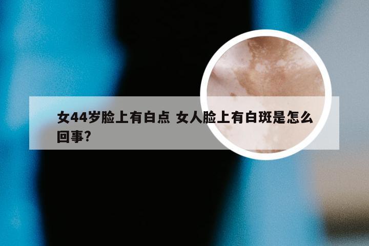 女44岁脸上有白点 女人脸上有白斑是怎么回事?