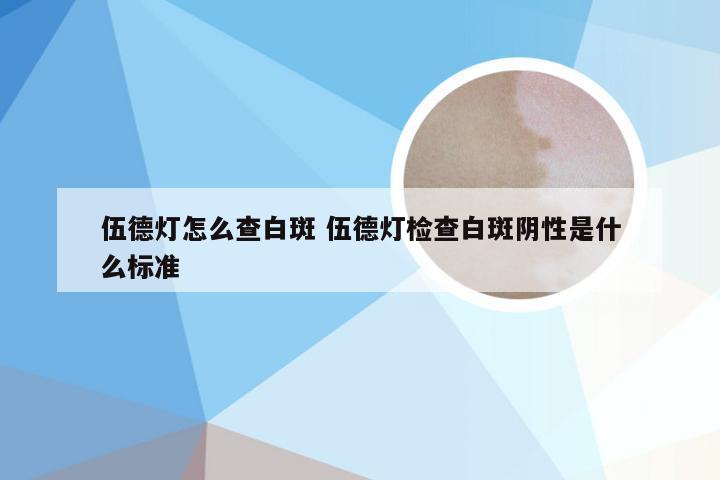 伍德灯怎么查白斑 伍德灯检查白斑阴性是什么标准