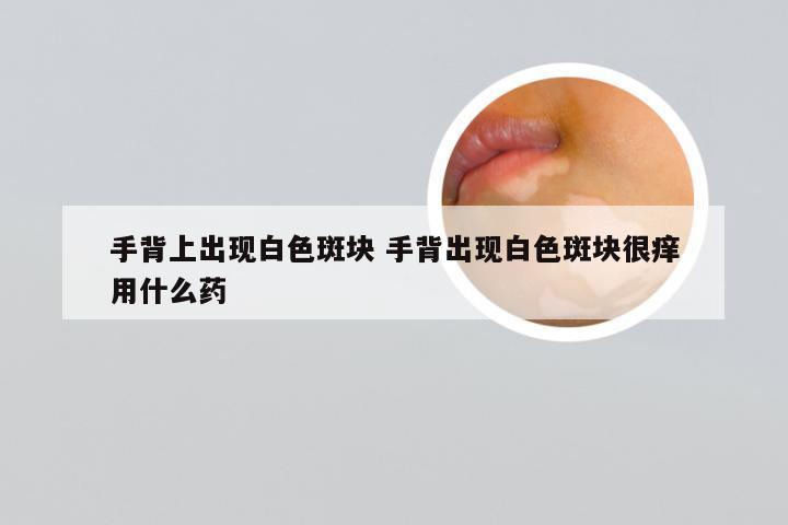 手背上出现白色斑块 手背出现白色斑块很痒用什么药