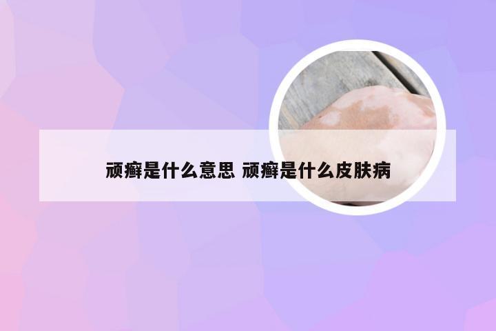 顽癣是什么意思 顽癣是什么皮肤病