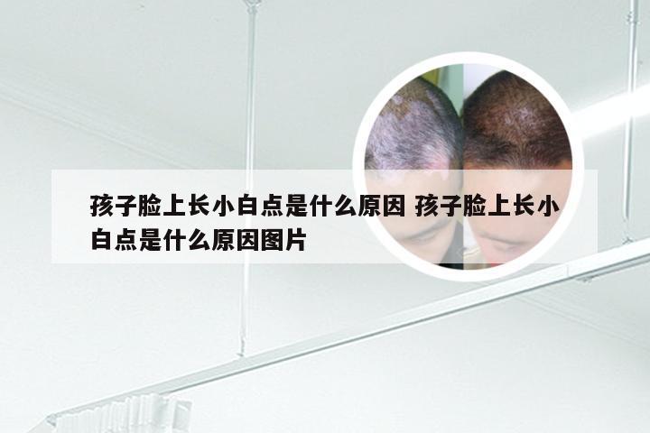 孩子脸上长小白点是什么原因 孩子脸上长小白点是什么原因图片