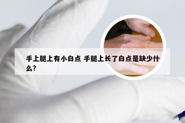 手上腿上有小白点 手腿上长了白点是缺少什么?