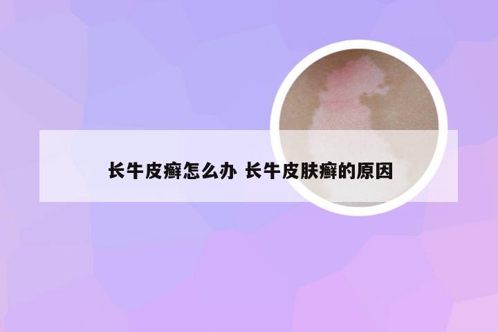 长牛皮癣怎么办 长牛皮肤癣的原因