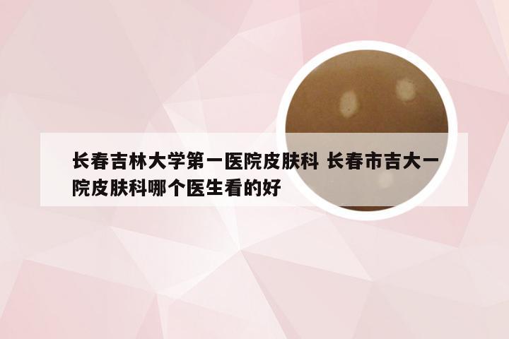 长春吉林大学第一医院皮肤科 长春市吉大一院皮肤科哪个医生看的好