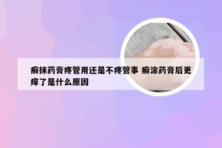 癣抹药膏疼管用还是不疼管事 癣涂药膏后更痒了是什么原因