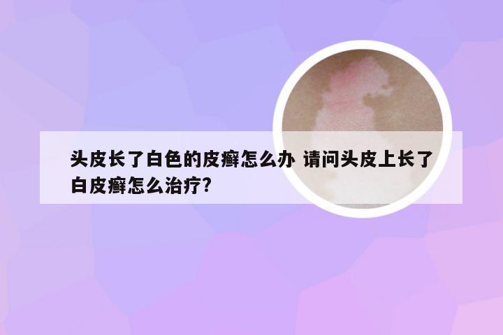 头皮长了白色的皮癣怎么办 请问头皮上长了白皮癣怎么治疗?