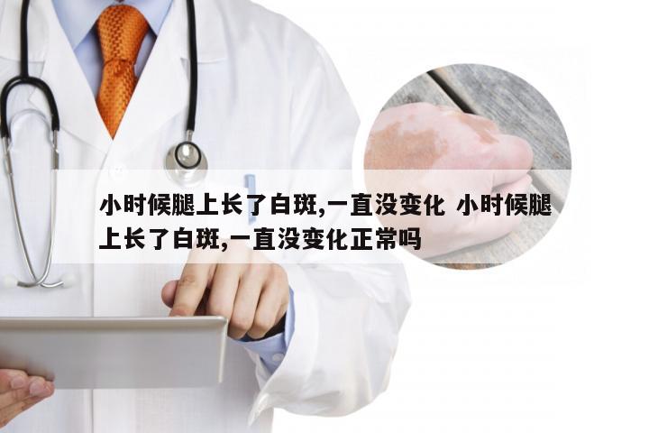 小时候腿上长了白斑,一直没变化 小时候腿上长了白斑,一直没变化正常吗