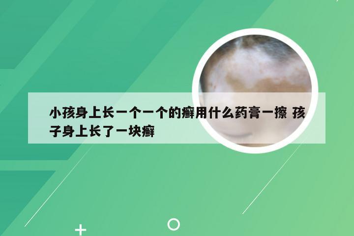 小孩身上长一个一个的癣用什么药膏一擦 孩子身上长了一块癣