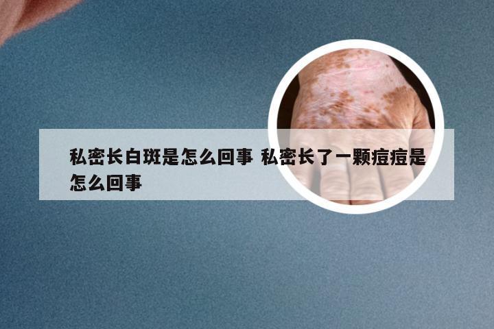 私密长白斑是怎么回事 私密长了一颗痘痘是怎么回事