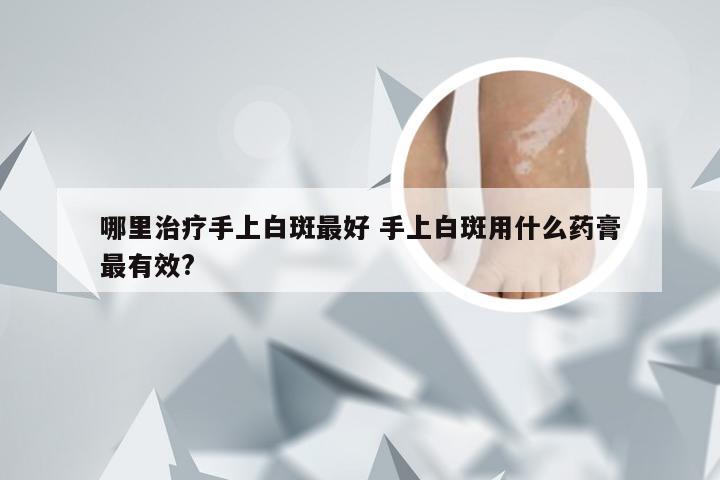 哪里治疗手上白斑最好 手上白斑用什么药膏最有效?