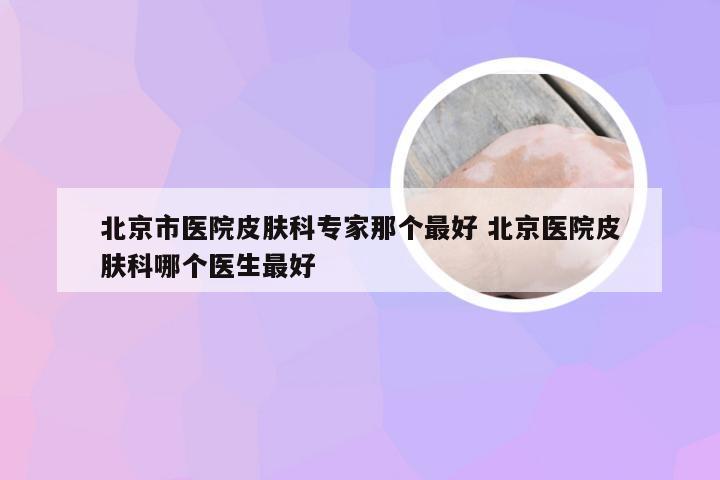 北京市医院皮肤科专家那个最好 北京医院皮肤科哪个医生最好