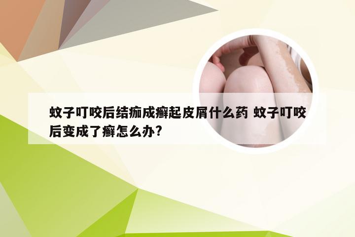 蚊子叮咬后结痂成癣起皮屑什么药 蚊子叮咬后变成了癣怎么办?