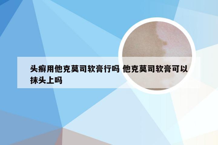 头癣用他克莫司软膏行吗 他克莫司软膏可以抹头上吗