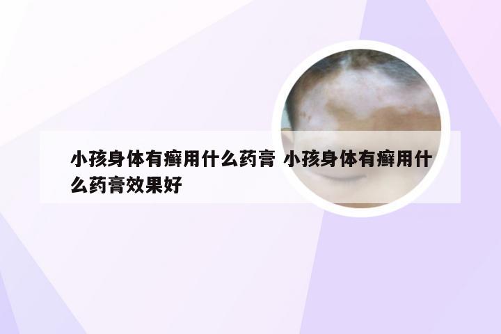 小孩身体有癣用什么药膏 小孩身体有癣用什么药膏效果好