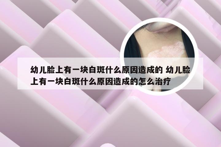 幼儿脸上有一块白斑什么原因造成的 幼儿脸上有一块白斑什么原因造成的怎么治疗