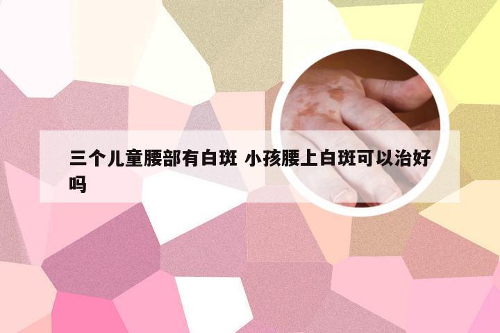 三个儿童腰部有白斑 小孩腰上白斑可以治好吗