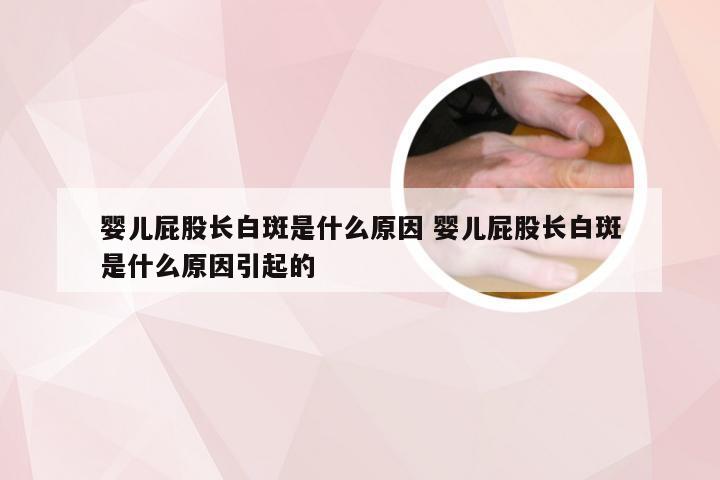 婴儿屁股长白斑是什么原因 婴儿屁股长白斑是什么原因引起的